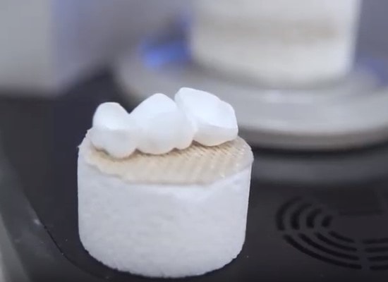 Protesi dentarie mobili